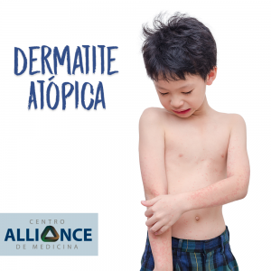 dermatite atópica